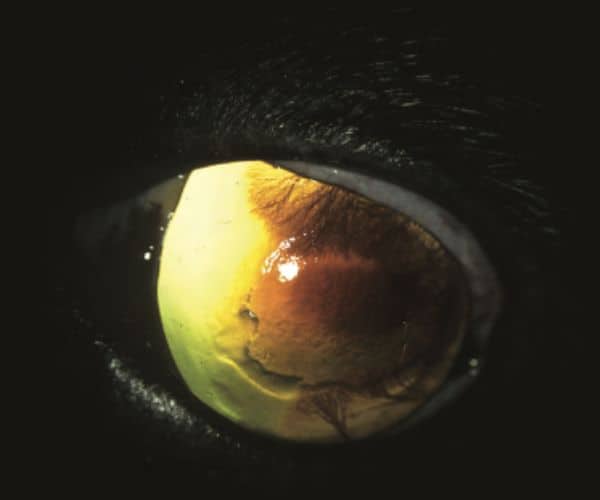 Corneal Sequestrum